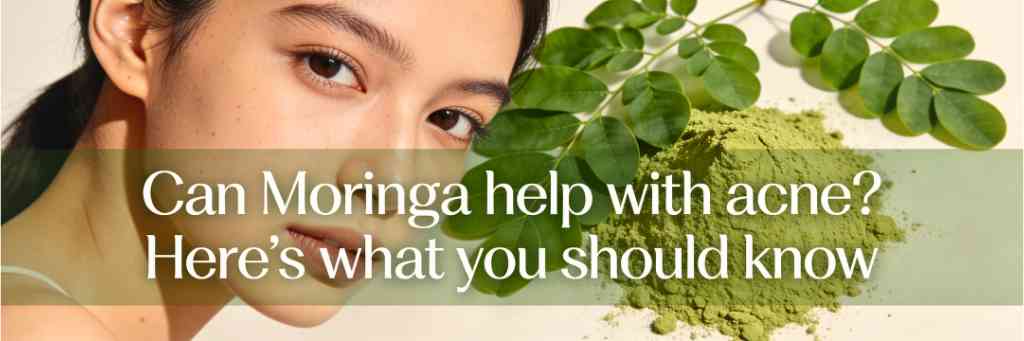 Can Moringa help with acne? Here’s what you should know